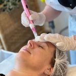 MIcroneedling training